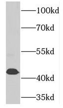 PCYT2 Antibody