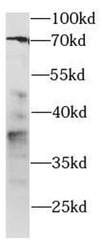PD-1 Antibody