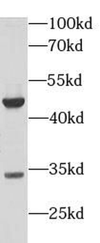 PD 1 Mouse Monoclonal Antibody