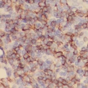 PD 1 Mouse Monoclonal Antibody