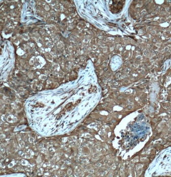 PDAP1 Antibody