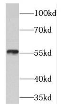 PDCD4 Rabbit Polyclonal Antibody