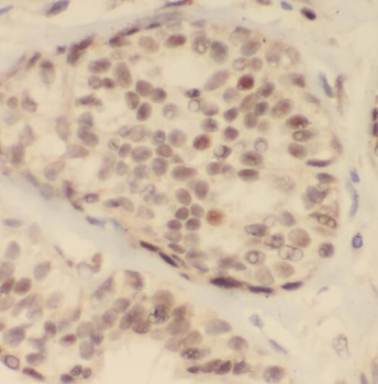 PDCD4 Mouse Monoclonal Antibody