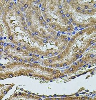 PDCD6IP Antibody