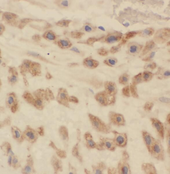 PDCL Antibody