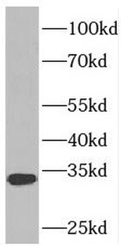 PDCL2 Antibody