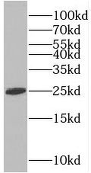 PDCL3 Antibody