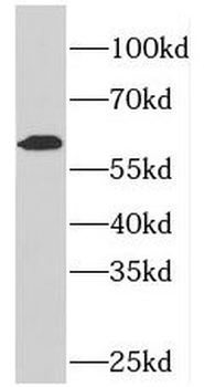 PDE1A Antibody