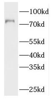 PDE4C Rabbit Polyclonal Antibody