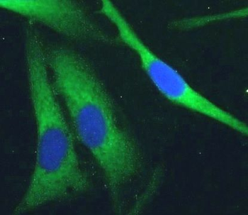 PDE5A Antibody