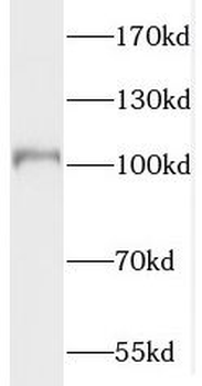 PDE6A Rabbit Polyclonal Antibody