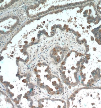 PDE6A Rabbit Polyclonal Antibody
