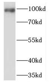 PDE6B Rabbit Polyclonal Antibody
