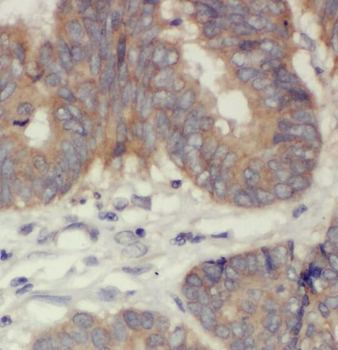 PDE8A Antibody