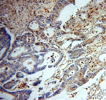 TYMP Antibody