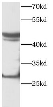 PDGFD Antibody