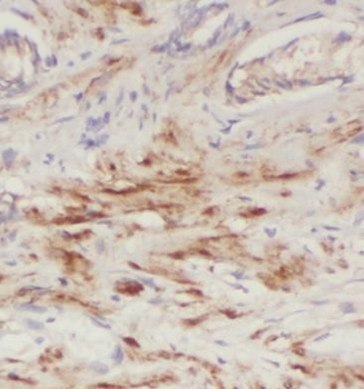 PDGFD Antibody
