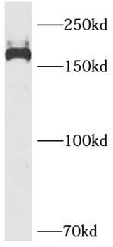 PDGFRB Rabbit Polyclonal Antibody