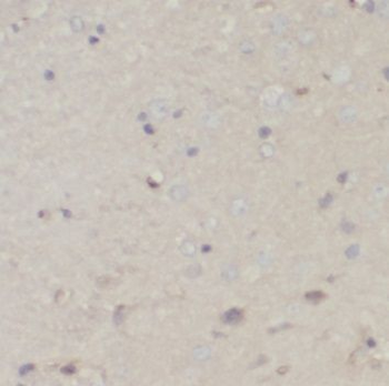 PDHA1 Antibody