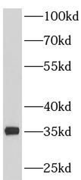 PDHB Antibody