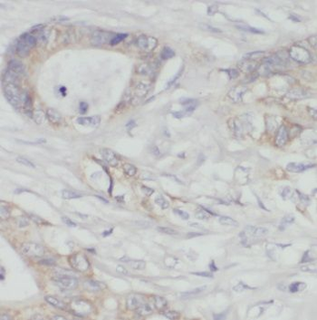 PDHX Antibody
