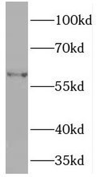 PDIA5 Antibody