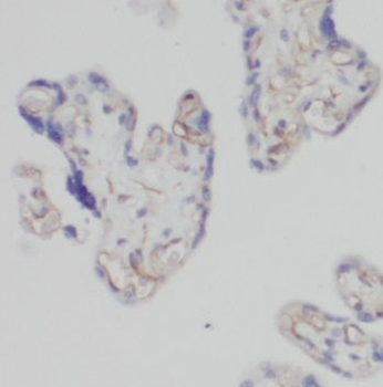 PDIA5 Antibody