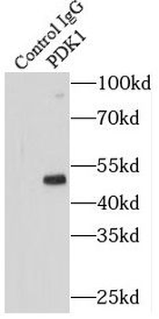 PDK1 Antibody