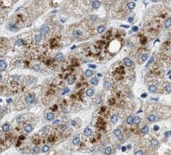 PDK1 Antibody