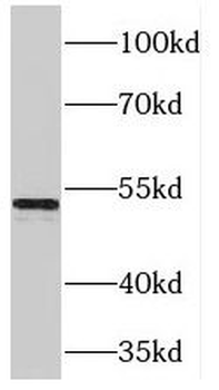 PDK1 Rabbit Polyclonal Antibody