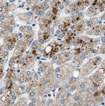 PDK1 Rabbit Polyclonal Antibody