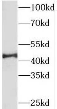 PDK4 Antibody