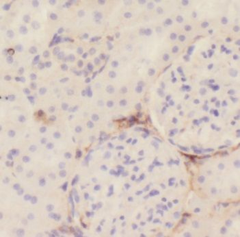 PDK4 Antibody