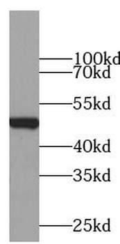 CD274 Antibody