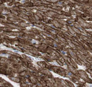 CD274 Antibody
