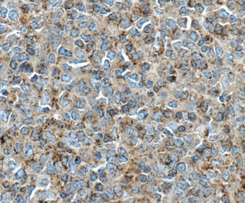 CD274 Mouse Monoclonal Antibody