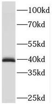 PDLIM3 Antibody