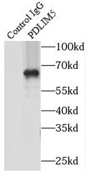 PDLIM5 Antibody