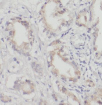 PDLIM5 Antibody