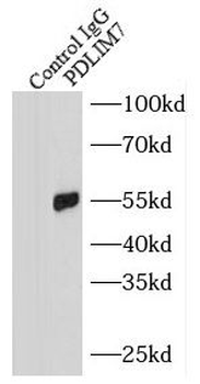 PDLIM7 Antibody