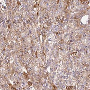 PDLIM7 Antibody