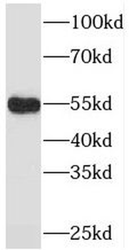 PDLIM7 Antibody