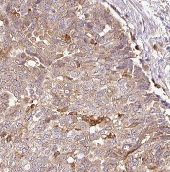 PDLIM7 Antibody