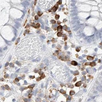 PDS5A Antibody