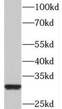PDSS2 Antibody