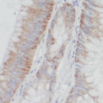 PDXK Antibody