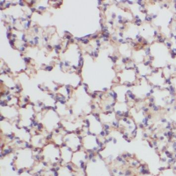 PDZD2 Rabbit Polyclonal Antibody