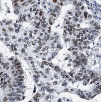 PELO Antibody