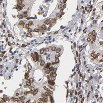 PEPD Antibody