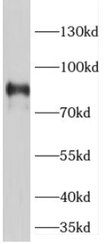 POSTN Antibody